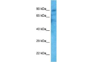 WB Suggested Anti-TRPV2 antibody Titration: 1 ug/mL Sample Type: Human HT1080 Whole Cell (TRPV2 anticorps  (C-Term))