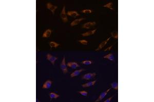 anti-Follistatin-Like 4 (FSTL4) antibody