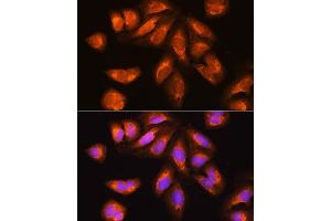 Immunofluorescence analysis of U2OS cells using EXOSC2 Rabbit pAb (ABIN6127886, ABIN6140374, ABIN6140375 and ABIN6214708) at dilution of 1:100.