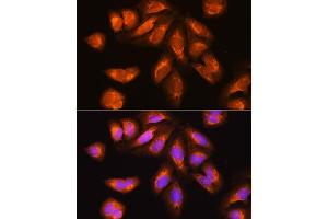 Immunofluorescence analysis of U2OS cells using EXOSC2 Rabbit pAb (ABIN6127886, ABIN6140374, ABIN6140375 and ABIN6214708) at dilution of 1:100. (EXOSC2 anticorps  (AA 1-293))