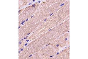 A staining MYBPC3 in human skeletal muscle tissue sections by Immunohistochemistry (IHC-P - paraformaldehyde-fixed, paraffin-embedded sections).
