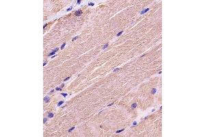 A staining MYBPC3 in human skeletal muscle tissue sections by Immunohistochemistry (IHC-P - paraformaldehyde-fixed, paraffin-embedded sections). (MYBPC3 anticorps  (N-Term))