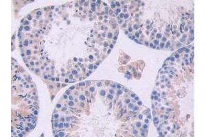Detection of OSM in Mouse Testis Tissue using Polyclonal Antibody to Oncostatin M (OSM)