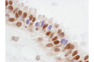 anti-CoaA (AA 150-200) antibody