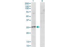 Western Blot analysis of MIS12 expression in transfected 293T cell line by MIS12 monoclonal antibody (M01), clone 1G3. (MIS12 anticorps  (AA 1-205))
