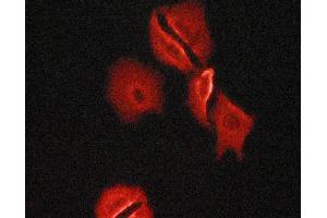 Tubulin alpha staining Human fetal heart cells by ICC/IF.