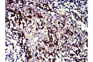 Immunohistochemical analysis of paraffin-embedded tonsil tissues using CD319 mouse mAb with DAB staining.