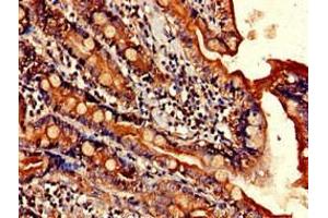 Immunohistochemistry of paraffin-embedded human small intestine tissue using ABIN7151564 at dilution of 1:100