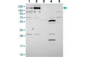 Western blot analysis of Lane 1: RT-4, Lane 2: U-251 MG, Lane 3: Human Plasma, Lane 4: Liver, Lane 5: Tonsil with TMEM2 polyclonal antibody  at 1:250-1:500 dilution. (TMEM2 anticorps)