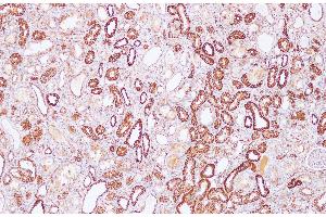 Immunohistochemistry of paraffin-embedded Rat kidney using Sptan1 Polyclonal Antibody at dilution of 1:100(100x)