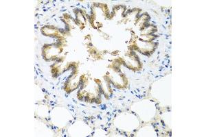 Immunohistochemistry of paraffin-embedded rat lung using S100A7 antibody (ABIN5974971) at dilution of 1/100 (40x lens). (S100A7 anticorps)