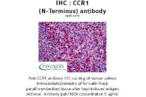 Image no. 1 for anti-Chemokine (C-C Motif) Receptor 1 (CCR1) (AA 7-24), (Extracellular Domain), (N-Term) antibody (ABIN1732755)
