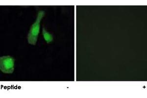 Immunofluorescence analysis of HeLa cells, using PPP1R14A polyclonal antibody . (CPI-17 anticorps)
