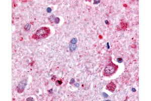 Anti-DPP6 antibody IHC of human brain, neurons.