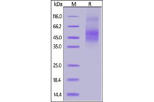 Cynomolgus Axl, His Tag on  under reducing (R) condition.