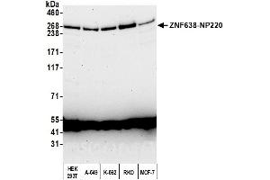 Western Blotting (WB) image for anti-Zinc Finger Protein 638 (ZNF638) (AA 1928-1978) antibody (ABIN7450948) (ZNF638 anticorps  (AA 1928-1978))