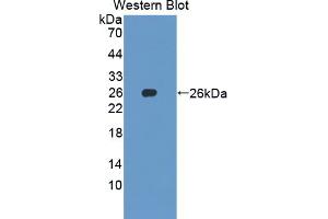 Figure. (SKP1 anticorps  (AA 1-163))