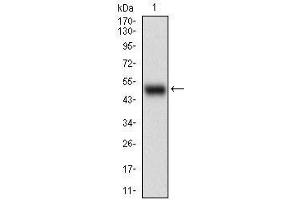 Western blot analysis using APBB1IP mAb against human APBB1IP (AA: 1-151) recombinant protein. (Amyloid beta (A4) Precursor Protein-Binding, Family B, Member 1 Interacting Protein (APBB1IP) (AA 1-151) anticorps)