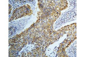 IHC analysis of DARS2 using anti-DARS2 antibody (ABIN6719279). (DARS2 anticorps  (AA 334-448))