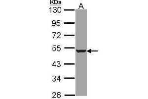 WB Image Sample (30 ug of whole cell lysate) A: A431 , 10% SDS PAGE HADHB antibody antibody diluted at 1:1000 (HADHB anticorps  (N-Term))