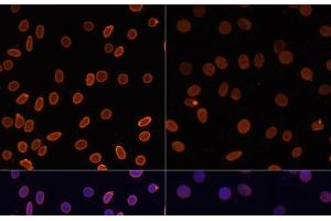 Immunofluorescence analysis of C6 cells using Acetyl-Histone H2A-K5 Polyclonal Antibody at dilution of 1:100.
