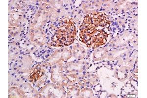 Paraformaldehyde-fixed, paraffin embedded mouse kidney tissue, Antigen retrieval by boiling in sodium citrate buffer(pH6) for 15min, Block endogenous peroxidase by 3% hydrogen peroxide for 30 minutes, Blocking buffer (normal goat serum) at 37°C for 20min, Antibody incubation with Rabbit Anti-Podocin Polyclonal Antibody, Unconjugated  at 1:200 overnight at 4°C, followed by a conjugated secondary and DAB staining