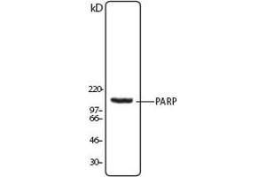 Image no. 1 for anti-Poly (ADP-Ribose) Polymerase 1 (PARP1) (N-Term) antibody (ABIN307559)