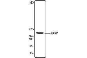 Image no. 1 for anti-Poly (ADP-Ribose) Polymerase 1 (PARP1) (N-Term) antibody (ABIN307559) (PARP1 anticorps  (N-Term))