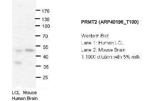 Image no. 1 for anti-Protein Arginine Methyltransferase 2 (PRMT2) (N-Term) antibody (ABIN2778663) (PRMT2 anticorps  (N-Term))