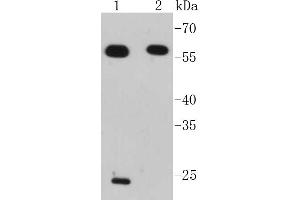 Lane 1: Jurkat, Lane 2: Raji lysates probed with IRF7 (2A1) Monoclonal Antibody  at 1:1000 overnight at 4˚C.
