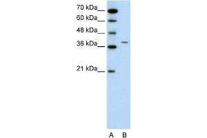 WB Suggested Anti-RAPSN Antibody Titration:  0.