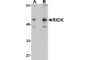 Western Blotting (WB) image for anti-Receptor-Interacting Serine-threonine Kinase 2 (RIPK2) (C-Term) antibody (ABIN1030619) (RIPK2 anticorps  (C-Term))