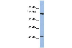 SLIT1 antibody used at 1 ug/ml to detect target protein. (SLIT1 anticorps)