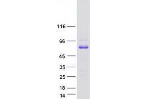 Validation with Western Blot