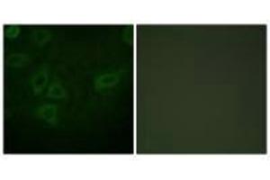 Immunofluorescence analysis of HepG2 cells, using TK (Ab-13) antibody.