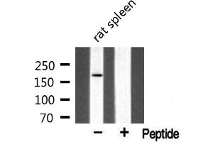 Western blot analysis of extracts from rat spleen, using MLH3 antibody. (MLH3 anticorps  (Internal Region))