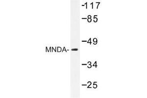 Image no. 1 for anti-Myeloid Cell Nuclear Differentiation Antigen (MNDA) antibody (ABIN317919) (MNDA anticorps)