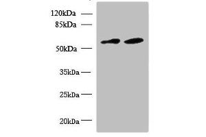 Western blot All lanes: KBTBD4 antibody at 10 μg/mL Lane 1: U87 whole cell lysate Lane 2: NIH/3T3 whole cell lysate Secondary Goat polyclonal to rabbit IgG at 1/10000 dilution Predicted band size: 59, 60 kDa Observed band size: 59 kDa (KBTBD4 anticorps  (AA 151-415))