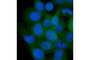 IF analysis of AHA1/AHSA1 using anti-AHA1/AHSA1 antibody (ABIN7600708). (AHSA1 anticorps  (AA 221-264))