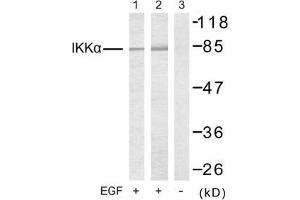 Image no. 2 for anti-conserved Helix-Loop-Helix Ubiquitous Kinase (CHUK) (Thr23) antibody (ABIN197306) (IKK alpha anticorps  (Thr23))