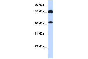 WB Suggested Anti-GUCY1B3 Antibody Titration:  0. (GUCY1B3 anticorps  (N-Term))