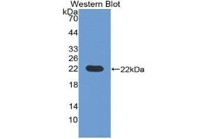 Western blot analysis of the recombinant protein. (Pronociceptin (AA 20-176) anticorps)