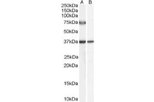 Image no. 1 for anti-Acyl-CoA Oxidase 2, Branched Chain (Acox2) (C-Term), (Internal Region) antibody (ABIN374845) (Acox2 anticorps  (C-Term, Internal Region))