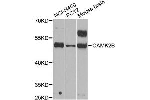 Western blot analysis of extracts of various cell lines, using CAMK2B antibody (ABIN1871413) at 1:1000 dilution. (CAMK2B anticorps)