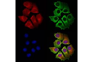 ABIN6263909 and ABIN6272972 staining Hela cells by IF/ICC.