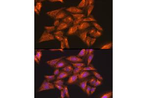 Immunofluorescence analysis of U-2 OS cells using IKKγ Rabbit pAb (ABIN3021150, ABIN3021151, ABIN3021152 and ABIN6214025) at dilution of 1:100 (40x lens). (IKBKG anticorps  (AA 1-419))
