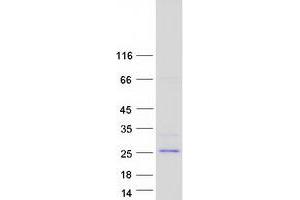 Validation with Western Blot