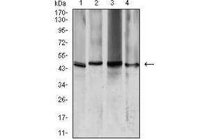 Western blot analysis using AQP2 mouse mAb against K562 (1), HeLa (2), HCT116 (3), and SW480 (4) cell lysate. (AQP2 anticorps  (AA 149-271))