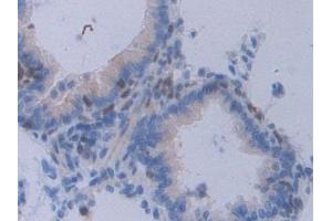Detection of STAT2 in Rat Lung Tissue using Polyclonal Antibody to Signal Transducer And Activator Of Transcription 2 (STAT2)