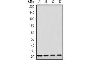 Western blot analysis of GrpEL2 expression in K562 (A), MCF7 (B), mouse brain (C), mouse lung (D) whole cell lysates. (GRPEL2 anticorps)